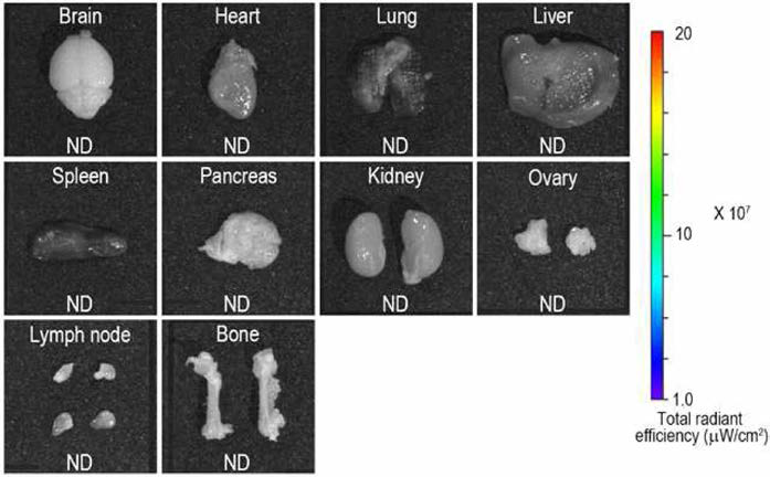 Representative ex vivo fluorescence optic images of various organs in female Balb/c nu/nu mouse injected with spheroids composed by CM-Dil labeled nerve derived stem cells at 1 day of injection