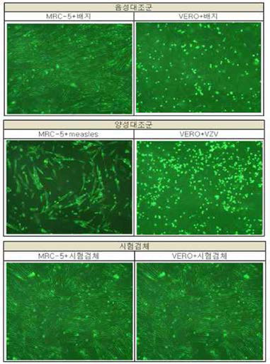 MRC 및 \tero 세포 기반 세포독성, 혈액응고, 혈구응집 여부를 통한 외래성 바이러스 감염여부 평가