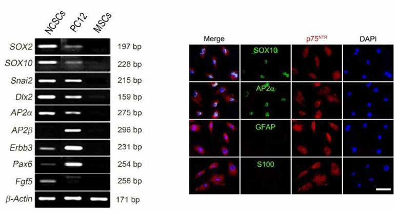 말초신경 유래 NCSC의 신경능선 특이 mRNA 발현 및 p75+ NCSC의 신경능선 특이 표지자의 발현율