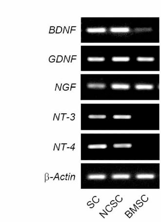 정성적 RT-PCR로 평가한 NCSC의 신경활성 mRNA의 발현 특성