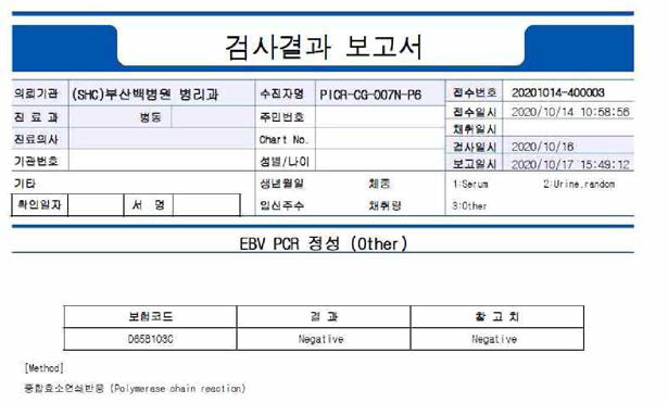 임상시험용 NCSC 원료세포의 EBV 검사결과 보고서