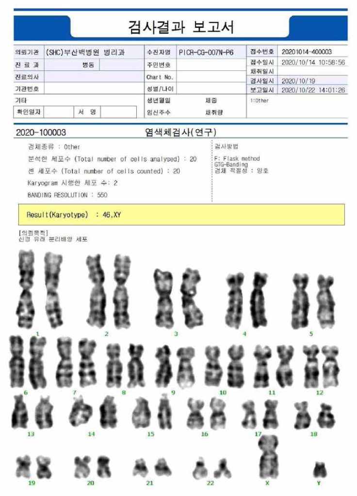 임상시험용 NCSC 원료세포의 핵형 검사 결과 보고서