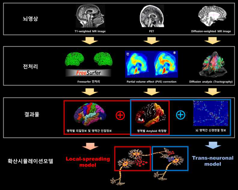 뇌 영상 전처리 과정