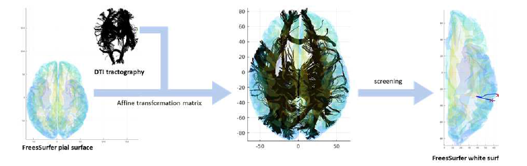 Transneuronal model을 위한 인접행렬 정의 처리 과정