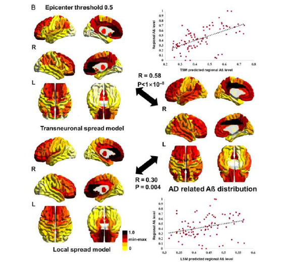 기존연구에서 아밀로이드-베타 단밸질의 local spreading과 transneuronal spreading의 확산 시물레이션 결과