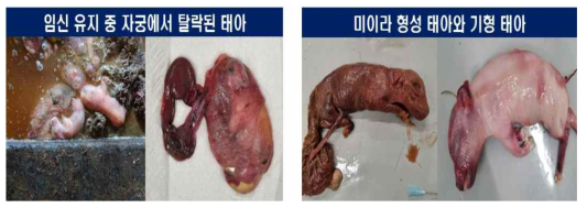 임신 유지 중 반출된 태아 (좌)와 비정상적으로 발달된 태아 (우)