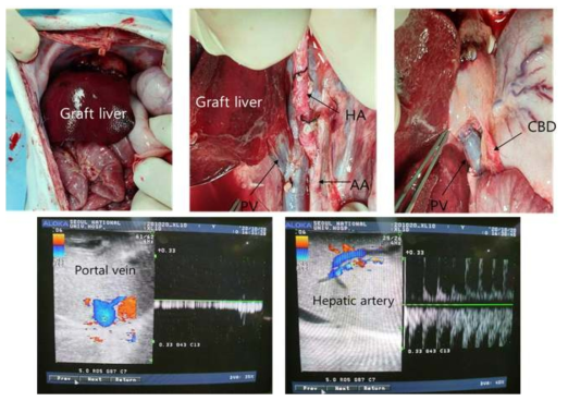 형질전환돼지의 간이식을 받은 4번 개체의 육안소견 및 초음파 소견