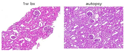 XK-26 이식 1주차 조직검사 소견과 부검 시 조직검사 소견