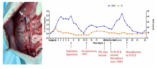 XK-21 이종 신장이식 수술 후 사진 및 수술 후 경과