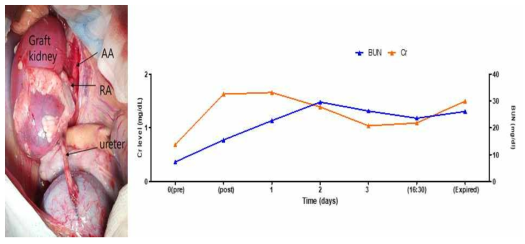 XK-22 이종 신장이식 수술 후 사진 및 수술 후 경과