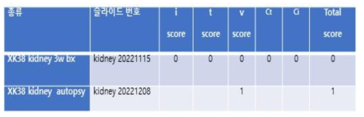 XK-38 3주차 이식신 조직검사에서는 염증세포 침윤 소견이 없었고 실험종료시 (6주) 이식신에서는 혈관에 염증세포 침윤 소견을 보임.