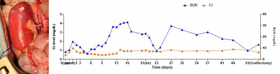 XK-39 개체의 수술 직후 사진과 수술 후 혈중 Cr, BUN level 그래프.
