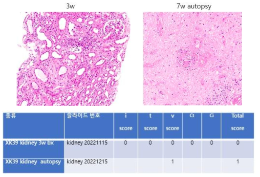 XK-39 개체 3주차 이식신 조직검사에서는 염증세포 침윤이 확실하게 보이지 않았으나, 실험종료시 (7주) 의 조직에서는 염증세포의 혈관침윤이 확인되었으며 interstitial edema 가 매우 심한 것을 확인할 수 있었음.
