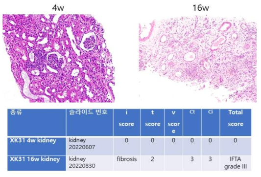 XK-31 개체의 이식신 조직검사 결과 3주차에는 염증세포 침윤이 없었으나 16주차에는 염증세포의 침윤이 있고 interstitium 의 edema 가 진행하였고 섬유화변화가 일어나는 것을 확인함