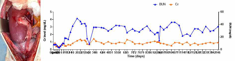 XK-33 개체의 수술 직후 사진과 수술 후 혈중 Cr, BUN level 그래프