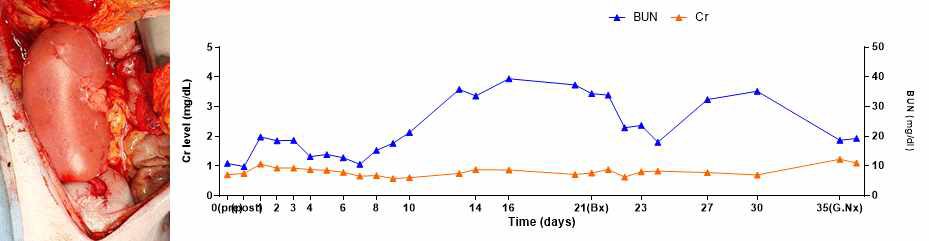XK-35 개체의 수술 직후 사진과 수술 후 혈중 Cr, BUN level 그래프