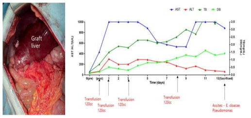 XL-27 의 수술 후 사진과 간기능 검사 수치 변화 추이