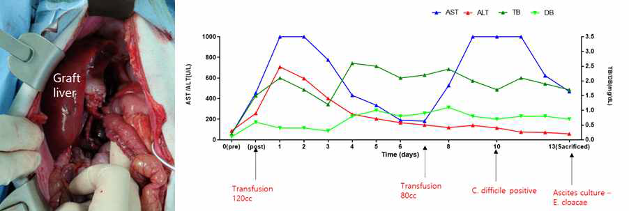 XL-28 의 수술 후 사진과 간기능 검사 수치 변화 추이