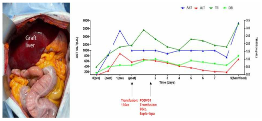 XL-29 의 수술 후 사진과 간기능 검사 수치 변화 추이