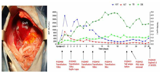 XL-31 의 수술 후 사진과 간기능 검사 수치 변화 추이