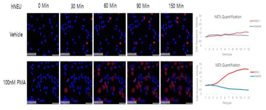 JuLI 세포 영상분석기로 NET 형성 여부 확인