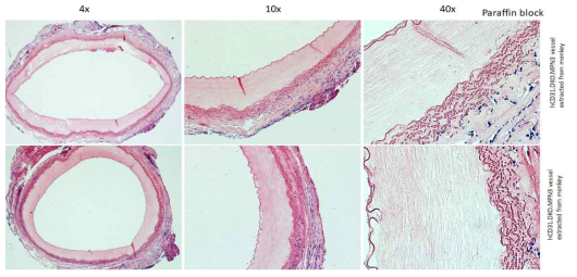 MPN3.DKO.hCD31 혈관도관 이식 및 적출 후 H&E 염색