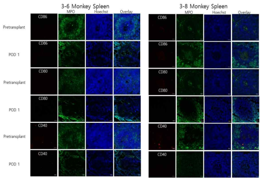 혈관도관 이식 전후 영장류 비장의 호중구에서 공동자극 분자 발현 분석