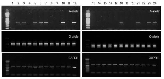 PCR을 이용한 ABO 유전형 분석 방법 예시