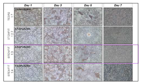 MCB 계대 후 TESR2와 STEMFIT 배양액의 세포 수 및 증식속도 비교