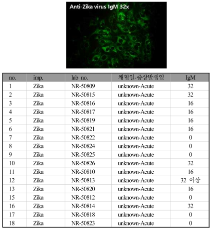 지카바이러스 IFA IgM 결과