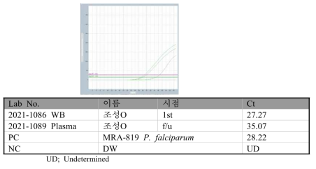 P. falciparum specific real-time PCR 결과