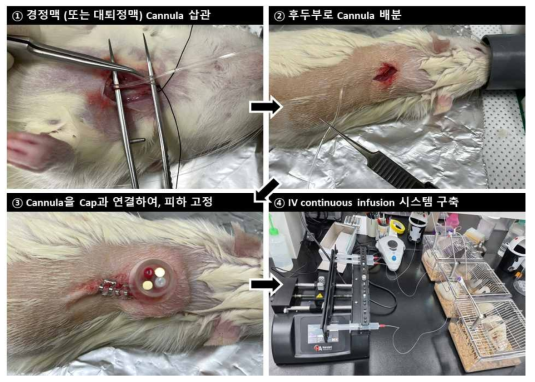 랫 정맥주입 시스템의 제작 과정