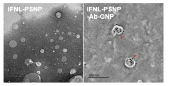 인터페론이 탑재된 폐계면활성제나노입자(좌) 및 금 나노입자 (우) 전자현미경 사진