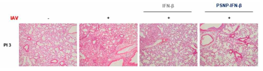 바이러스 감염 마우스 모델 IFNβ 흡입 전달 후 폐 조직 사진