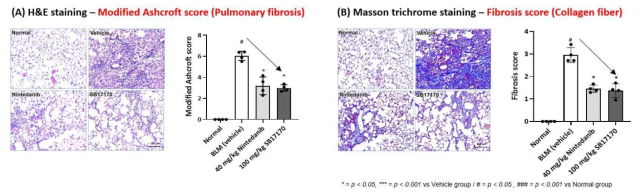 BILF 예방모델에서의 폐조직 평가 (A) H&E staining, (B) Masson trichrome staining