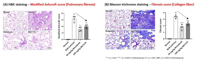 BILF 치료모델에서의 폐조직 평가 (A) H&E staining, (B) Masson trichrome staining