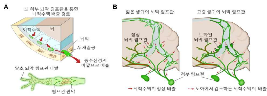 뇌막 림프관의 위치와 연령에 따른 구조 변화 과정 모식도