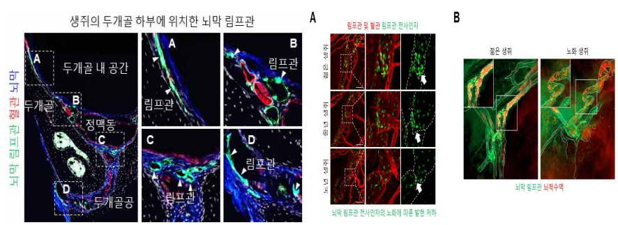 뇌 하부 뇌막 림프관 위치 및 노화에 따른 뇌막 림프관의 기능 저하