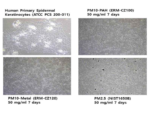 배양된 표피각질세포 PM처리