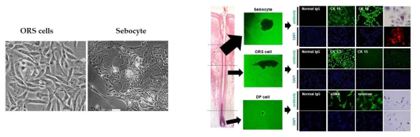 배양중인 외모근초세포와 피지세포 형태 및 형광염색이용 세포특성