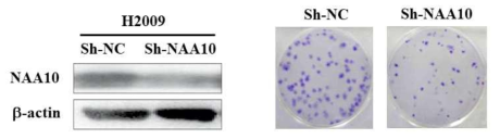 NAA10 knockdown 세포의 군락형성능 평가