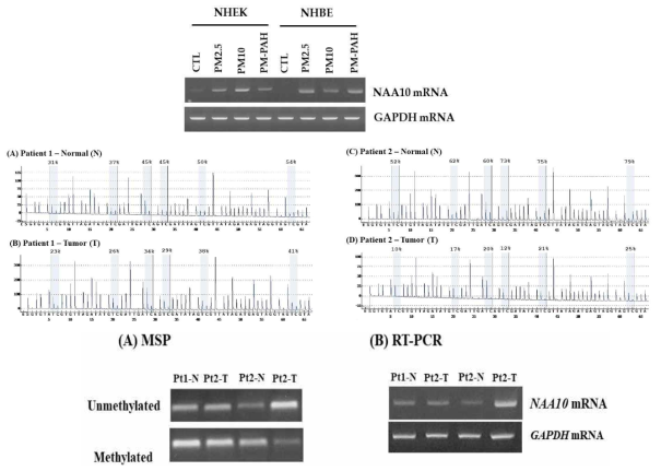 폐암환자의 NAA10 메틸화패턴 분석(pyrosequencing, MSP)과 mRNA 발현 변화