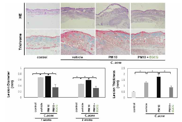 EGCG에 의한 C. acnes에 의해 유도된 여드름 마우스 모델에서 PM10 노출 환경에서 염증성 결절의 직경 및 두께의 변화