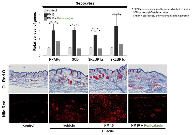 Punicalagin에 의한 피지세포에서의 피지 생성과 이와 연관된 인자인 PPAR-γ, SCD, SREBP1a, SREBP1c의 유전자 발현의 변화