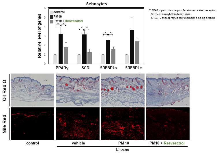 Resveratrol에 의한 피지세포에서의 피지 생성과 이와 연관된 인자인 PPAR-γ, SCD, SREBP1a, SREBP1c의 유전자 발현의 변화