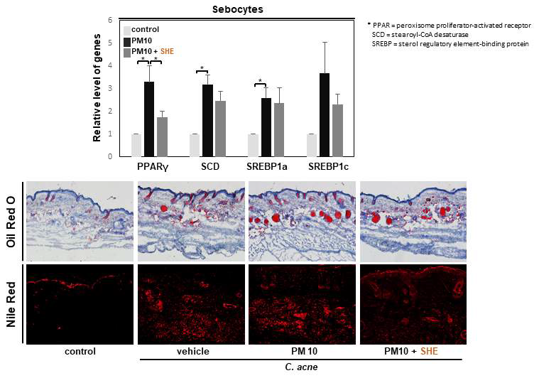 SHE에 의한 피지세포에서의 피지 생성과 이와 연관된 인자인 PPAR-γ, SCD, SREBP1a, SREBP1c의 유전자 발현의 변화