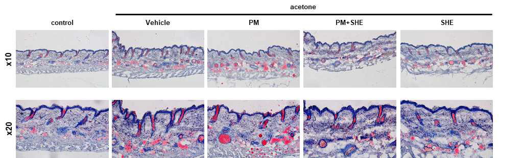 SHE는 아세톤에 의해 유도된 피부건조증 마우스 모델에서 PM10 노출 환경에서 피지 생성량에 미치는 영향