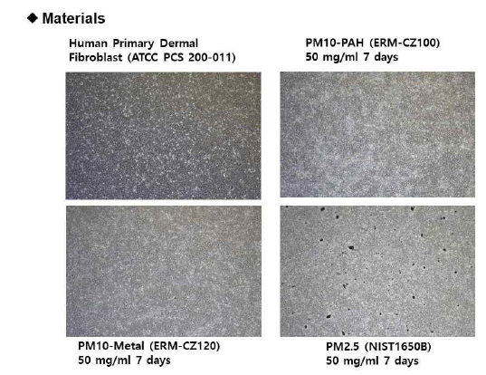PM처리 전·후 진피섬유모세포