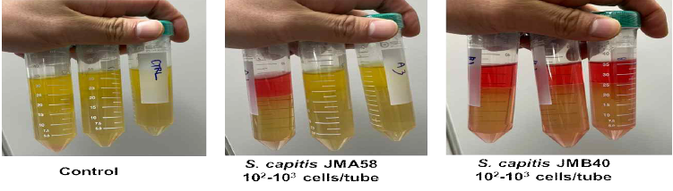 두피 유래 Staphylococcus와 human kerationocytes 공배양 시스템 구축