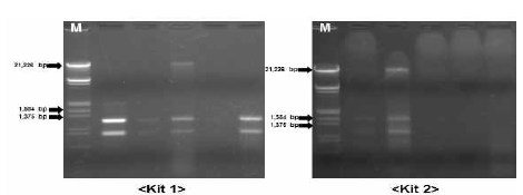 두피 유래 배양 균주 Total RNA 추출법 비교